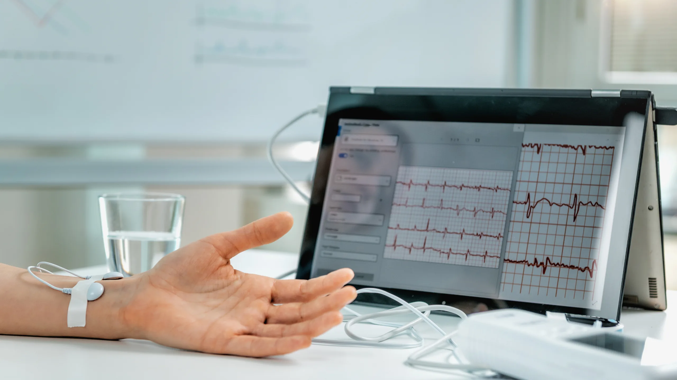 Hand mit Messelektrode am Handgelenk vor einem Tablet mit Messkurven